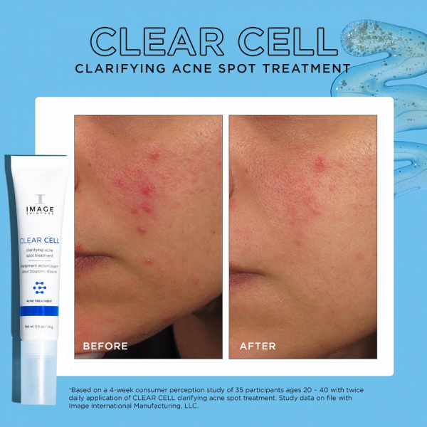 INCREDIBLY CLEAR ACNE SPOT - ACURE